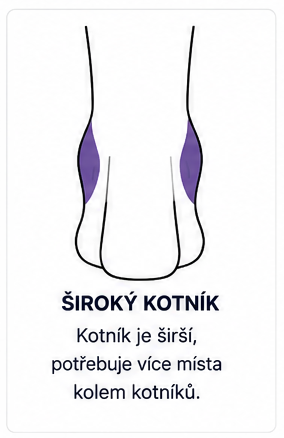 Široký kotník dítěte